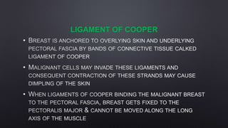 LIGAMENT OF COOPER
•
•
•
 
