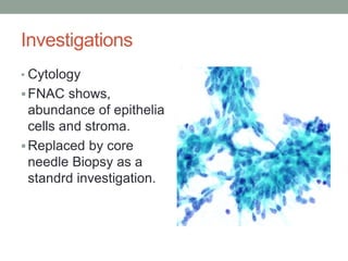 Investigations
• Cytology
FNAC shows,
abundance of epithelia
cells and stroma.
Replaced by core
needle Biopsy as a
standrd investigation.
 