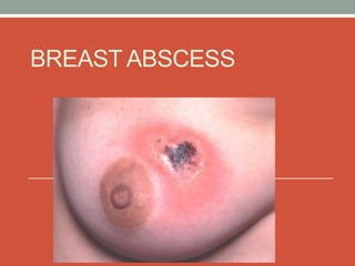 BREAST ABSCESS
 