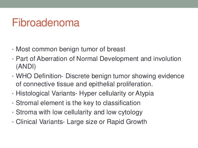 Benign Breast Tissue With Stromal Calcifications