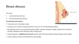 Female Abscess Benign Breast Disorders.pptx.knowledge attitude | PPTX