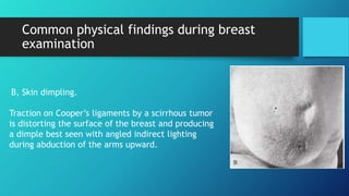 Benign breast lesions | PPTX
