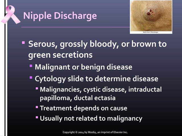 Benign breasts disorders | PPT