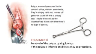 TREATMENT:
Removal of the polyps by ring forceps.
If the polyps is infected antibiotics may be prescribed.
 