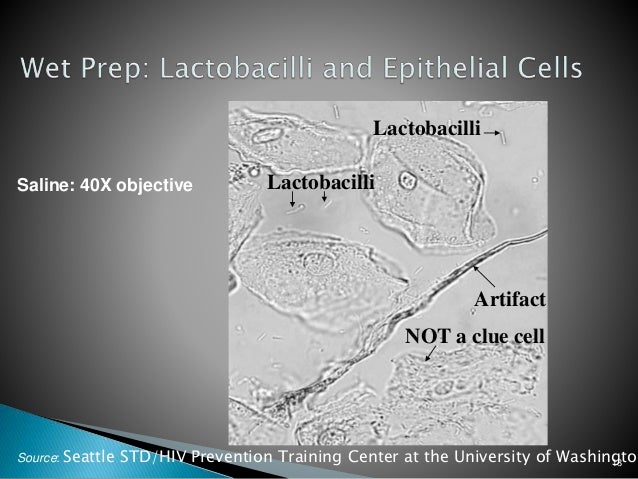 lactobacillus overgrowth