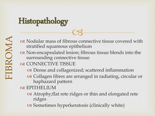 
 Nodular mass of fibrous connective tissue covered with
stratified squamous epithelium
 Non-encapsulated lesion; fibrous tissue blends into the
surrounding connective tissue
 CONNECTIVE TISSUE
 Dense and collagenized; scattered inflammation
 Collagen fibres are arranged in radiating, circular or
haphazard pattern
 EPITHELIUM
 Atrophy;flat rete ridges or thin and elongated rete
ridges
 Sometimes hyperkeratosis (clinically white)
FIBROMA
Histopathology
 