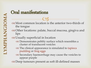
 Most common location is the anterior two-thirds of
the tongue
 Other locations: palate, buccal mucosa, gingiva and
lips
 Usually superficial in location
 Demonstrates pebbly surface which resembles a
cluster of translucent vesicles
 The clinical appearance is simulated to tapioca
pudding or frog eggs
 Secondary haemorrhage may cause the vesicles to
appear purple
 Deep tumours present as soft ill-defined masses
LYMPHANGIOMA
Oral manifestations
 