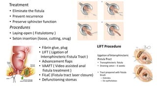 • Eliminate the fistula
• Prevent recurrence
• Preserve sphincter function
Procedures
• Laying-open ( Fistulotomy )
• Seton insertion (loose, cutting, snug)
• Fibrin glue, plug
• LIFT ( Ligation of
Intersphincteric Fistula Tract )
• Advancement flaps
• VAAFT ( Video assisted anal
fistula treatment )
• FiLaC (Fistula tract laser closure)
• Defunctioning stomas
Treatment
 