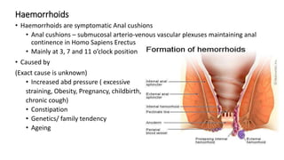 Haemorrhoids
• Haemorrhoids are symptomatic Anal cushions
• Anal cushions – submucosal arterio-venous vascular plexuses maintaining anal
continence in Homo Sapiens Erectus
• Mainly at 3, 7 and 11 o’clock position
• Caused by
(Exact cause is unknown)
• Increased abd pressure ( excessive
straining, Obesity, Pregnancy, childbirth,
chronic cough)
• Constipation
• Genetics/ family tendency
• Ageing
 