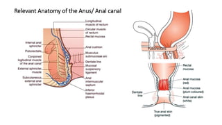 Relevant Anatomy of the Anus/ Anal canal
Puborectalis
 