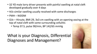 • 32 YO male lorry driver presents with painful swelling at natal cleft
developed gradually over 4 days
• H/o similar swelling usually resolved with some discharges
• PMH – NIDDM
• O/e – Hirsute, BMI 29, 3x3 cm swelling with an opening oozing at the
top of natal cleft with some surrounding cellulitis
• Temp 37.5, pulse 90/min, BP 142/65 mmHg
What is your Diagnosis, Differential
Diagnoses and Management?
 