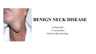 BENIGN NECK DISEASE
Dr Raju Kafle
3rd year Resident
NMCTH, ORL-HNS Dept.
1
 