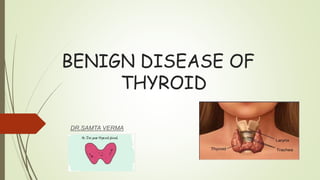 BENIGN DISEASE OF
THYROID
DR.SAMTA VERMA
 