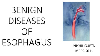 BENIGN
DISEASES
OF
ESOPHAGUS NIKHIL GUPTA
MBBS-2011
 