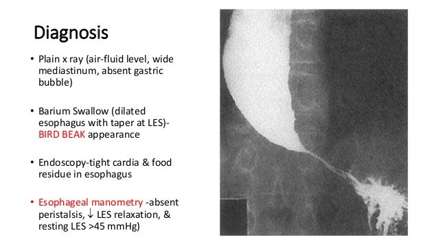 Esophagus