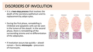 BENIGN DISEASES OF THE BREAST.pptx