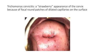 Benign diseases of the cervix lecture.pptx