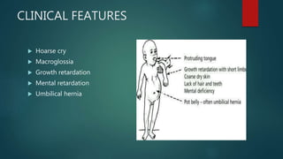 CLINICAL FEATURES
 Hoarse cry
 Macroglossia
 Growth retardation
 Mental retardation
 Umbilical hernia
 