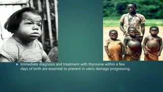  Immediate diagnosis and treatment with thyroxine within a few
days of birth are essential to prevent in utero damage progressing.
 