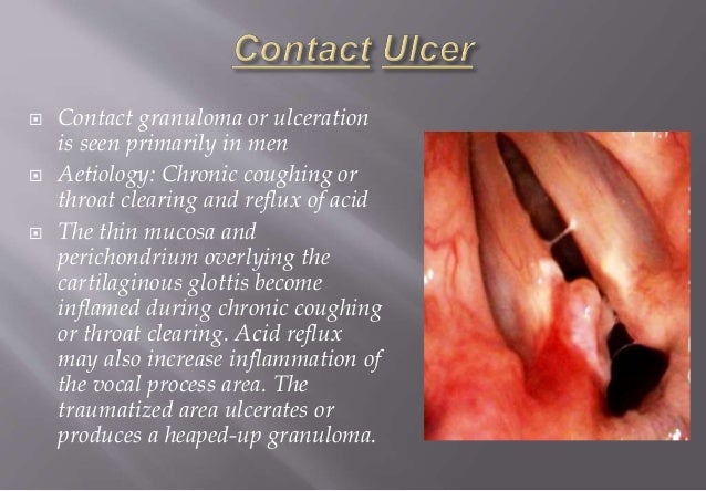 Benign disorders of larynx