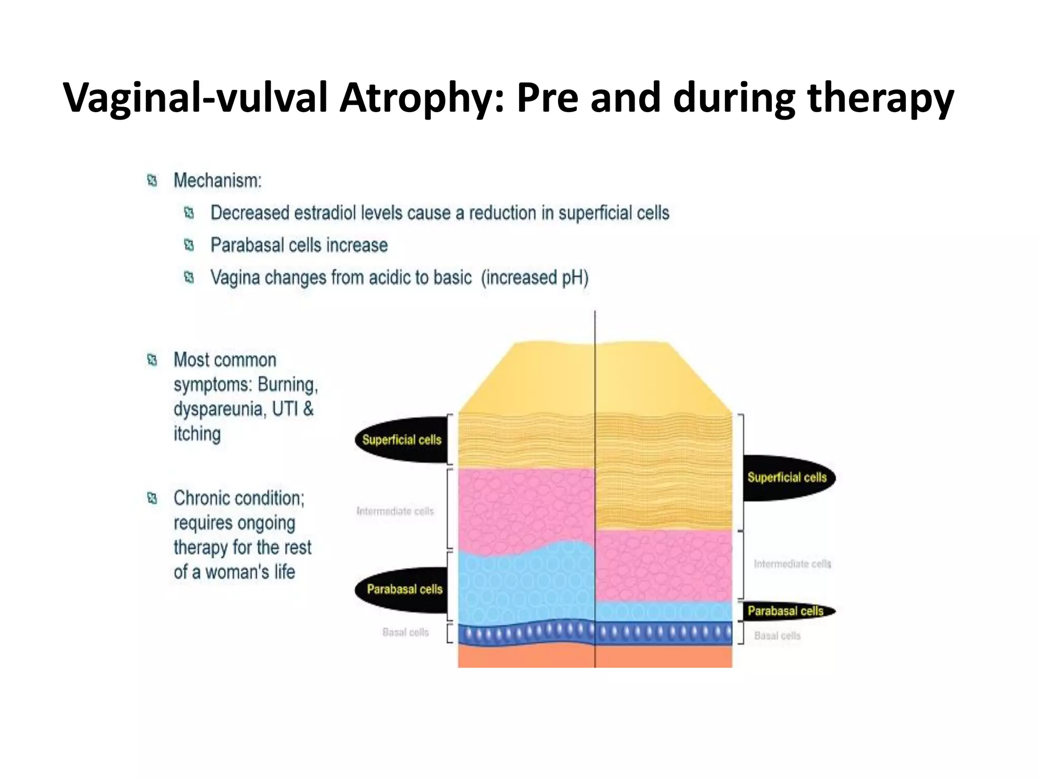 Benign Disorders of the Vulva: Pruritus (itchy) Vulva Vulval Skin and ...