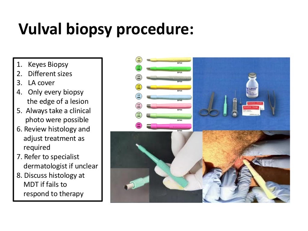 Benign Disorders of the Vulva Pruritus (itchy) Vulva Vulval Skin and…