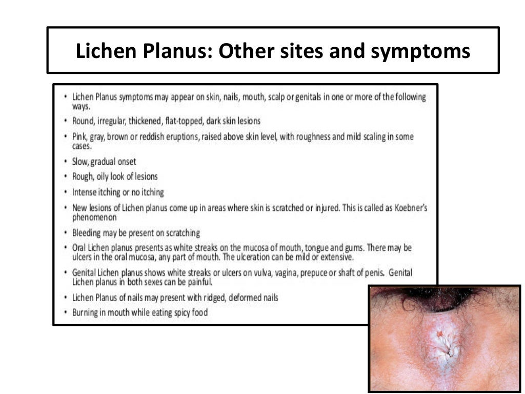 Benign Disorders of the Vulva Pruritus (itchy) Vulva Vulval Skin and…
