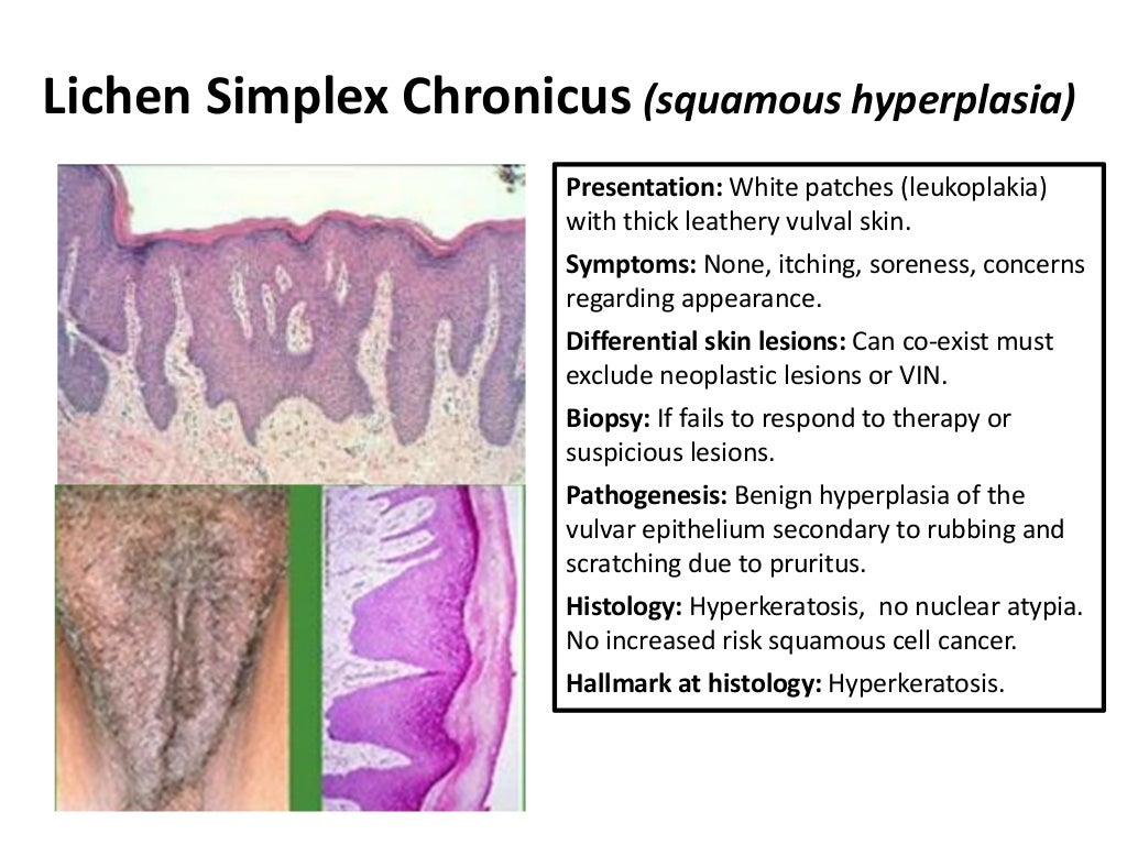 Benign Disorders of the Vulva Pruritus (itchy) Vulva Vulval Skin and…