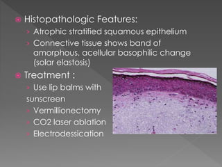 Benign Epithelial Pathology | PPTX