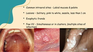 Benign Epithelial Tumors.PMNM Dental collegepptx | PPTX