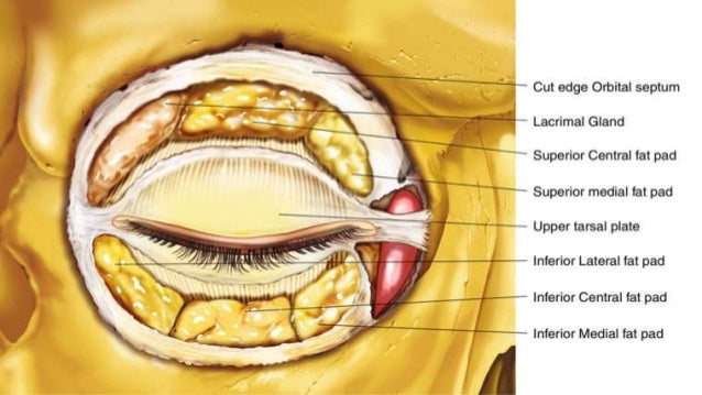 Benign eyelid tumors