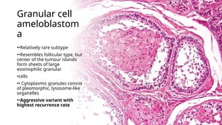 benign lesions-ceot,amelo,fibrooseous lesions.pptx