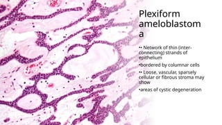 benign lesions-ceot,amelo,fibrooseous lesions.pptx