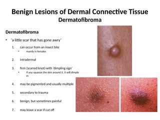 Benign Lesions of the Skin Clinical Pathology Study Questions_Mari ...
