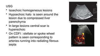 USG
• Isoechoic homogeneous lesions
• Hypoechoic halo is seen around the
lesion due to compressed liver
parenchyma
• In large lesions central scar is
hyperechoic
• On CDFI : stellate or spoke wheel
pattern is seen corresponding to
arteries running into radiating fibrous
septa
 