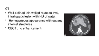 CT
• Well-defined thin walled round to oval,
intrahepatic lesion with HU of water
• Homogeneous appearance with out any
internal structures
• CECT : no enhancement
 