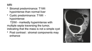 MRI
• Stromal predominance: T1WI
hypointense than normal liver
• Cystic predominance: T1WI -
hypointense
T2WI - markedly hyperintense with
multiple septa traversing the tumor,
indicating that the mass is not a simple cyst
• Post contrast : stromal components may
enhance
 