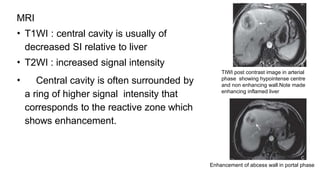 MRI
• T1WI : central cavity is usually of
decreased SI relative to liver
• T2WI : increased signal intensity
• Central cavity is often surrounded by
a ring of higher signal intensity that
corresponds to the reactive zone which
shows enhancement.
TIWI post contrast image in arterial
phase showing hypointense centre
and non enhancing wall.Note made
enhancing inflamed liver
Enhancement of abcess wall in portal phase
 