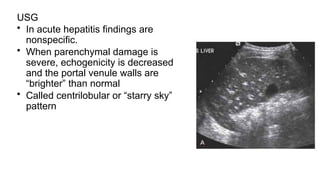 USG
• In acute hepatitis findings are
nonspecific.
• When parenchymal damage is
severe, echogenicity is decreased
and the portal venule walls are
“brighter” than normal
• Called centrilobular or “starry sky”
pattern
 