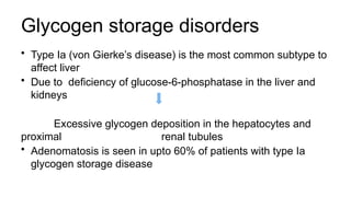 Glycogen storage disorders
• Type Ia (von Gierke’s disease) is the most common subtype to
affect liver
• Due to deficiency of glucose-6-phosphatase in the liver and
kidneys
Excessive glycogen deposition in the hepatocytes and
proximal renal tubules
• Adenomatosis is seen in upto 60% of patients with type Ia
glycogen storage disease
 