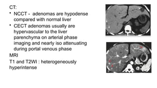 CT:
• NCCT - adenomas are hypodense
compared with normal liver
• CECT adenomas usually are
hypervascular to the liver
parenchyma on arterial phase
imaging and nearly iso attenuating
during portal venous phase
MRI
T1 and T2WI : heterogeneously
hyperintense
 