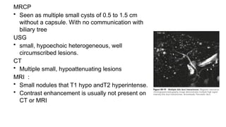 MRCP
• Seen as multiple small cysts of 0.5 to 1.5 cm
without a capsule. With no communication with
biliary tree
USG
• small, hypoechoic heterogeneous, well
circumscribed lesions.
CT
• Multiple small, hypoattenuating lesions
MRI :
• Small nodules that T1 hypo andT2 hyperintense.
• Contrast enhancement is usually not present on
CT or MRI
 