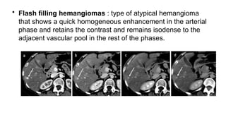 • Flash filling hemangiomas : type of atypical hemangioma
that shows a quick homogeneous enhancement in the arterial
phase and retains the contrast and remains isodense to the
adjacent vascular pool in the rest of the phases.
 