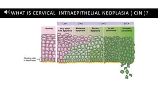 Cgin BENIGN & MALIGNANT CERVICAL DISEASE (1).pdf