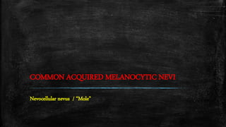 COMMON ACQUIRED MELANOCYTIC NEVI
Nevocellular nevus / “Mole”
 