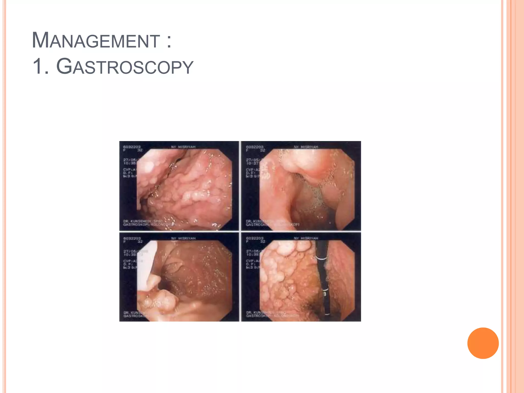 MANAGEMENT :
1. GASTROSCOPY
 