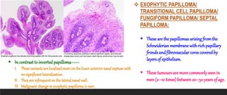  EXOPHYTIC PAPILLOMA/
TRANSITIONAL CELL PAPILLOMA/
FUNGIFORM PAPILLOMA/ SEPTAL
PAPILLOMA:
 These are the papillomas arising fromthe
Schneiderian membrane withrich papillary
fronds and fibrovascular cores covered by
layersof epithelium.
 These tumours are more commonly seen in
men (2–10 times) between 20–50 years of age.
 In contrast to invertedpapilloma------
I. Thesevariants are localised more on the lower anterior nasal septumwith
no significant lateralisation.
II. They are infrequent on the lateral nasal wall.
III. Malignant change in exophytic papilloma is rare.
 
