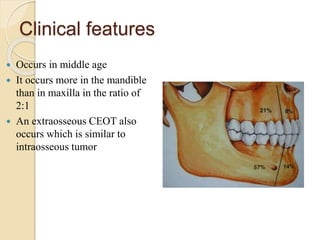 BENIGN ODONTOGENIC TUMORS.pptx
