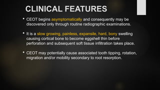 Seminar on Benign Odontogenic tumors ( PG OMFS ) | PPTX
