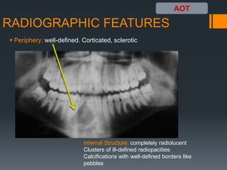 Aot Radiograph Benign odontogenic tumors 1 | PPTX